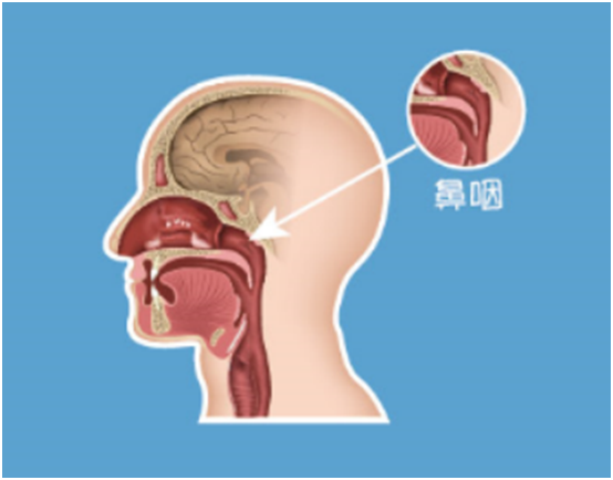 鼻咽癌治疗首选不是手术？ 接受放疗的患者治愈率超过80%！