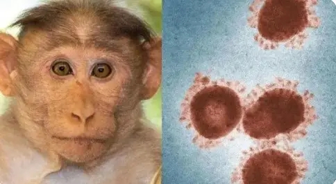 猴痘袭多国，意味着什么？